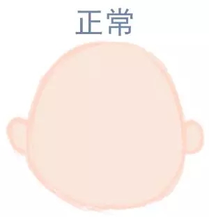 宝宝圆头好照旧扁头好？？？这些神秘许多爸妈都不知道5.webp.jpg